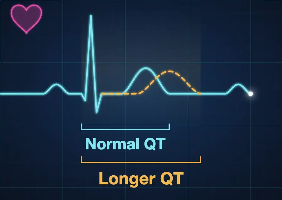EKG illustration comparing a normal QT interval with a longer QT interval